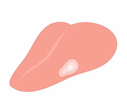 舌のイラスト